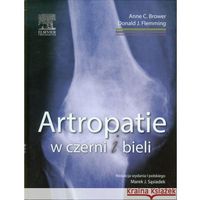 Książki medyczne, artropatie w czerni i bieli (opr. twarda)